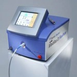 Endoluminal Laser Ablation